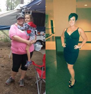 Before and After weight lost photos